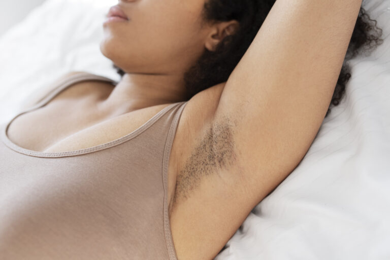 3 wavelength diode laser hair removal